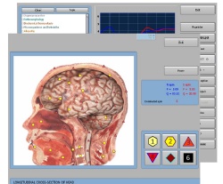 JYTOP Health Computer Software System Health Test Therapy Computer Gadge 18D Hunter4025