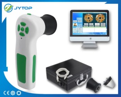 JYtop High Resolution CCD USB Iriscope Diagnostic Eye Camera With 12MP HD 30x Iris Lens